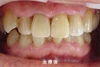 AFTER