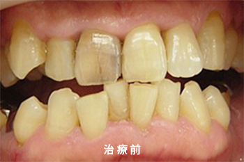 BEFORE